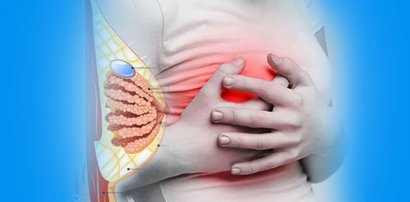 Can Fibrocystic Breast Disease turn into Cancer?